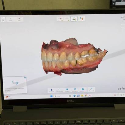 impronta-digitale-napoli-paziente-dentista-cutuli